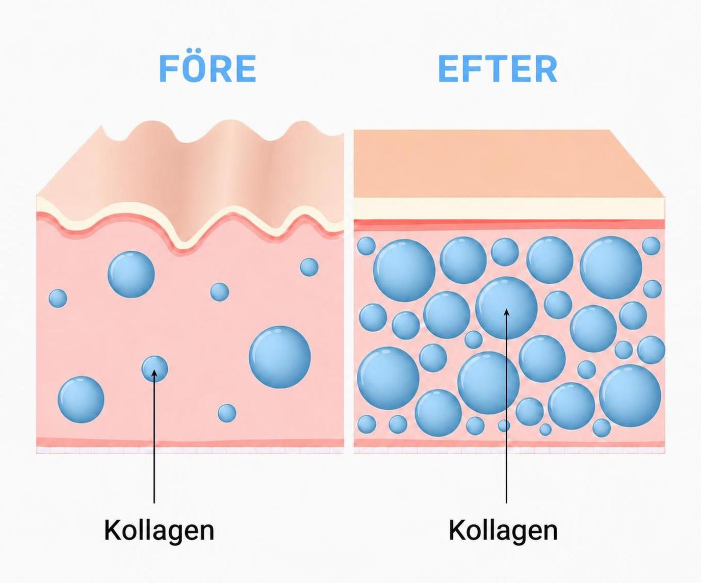 Comparison of skin before and after taking collagen