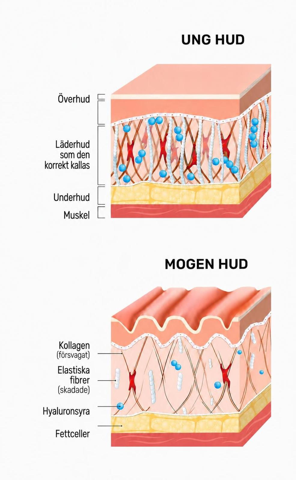 Comparison of young and older skin
